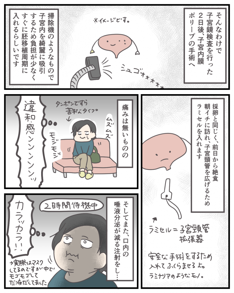 子宮内膜ポリープの手術を した 人の話